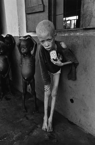 biafra 1969 a starving albino boy harassed and discriminated against for the colour of his skin clutches an empty corned beef tin at an orphanage